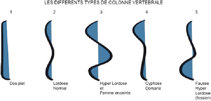 Les différents types de colonne vertébrale